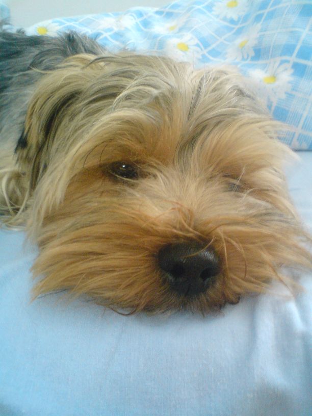 Co to jest zastawka wątroby?